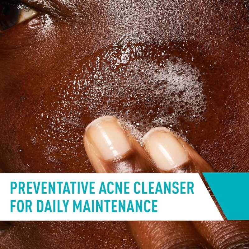 CeraVe Acne Control Cleanser, 2% Salicylic Acid Treatment Formulated With Niacinamide + Ceramides + Oil Absorbing Clay, Gentle Face Wash Helps Clear & Prevent Acne, Fragrance Free, 16 Ounce - Image 4