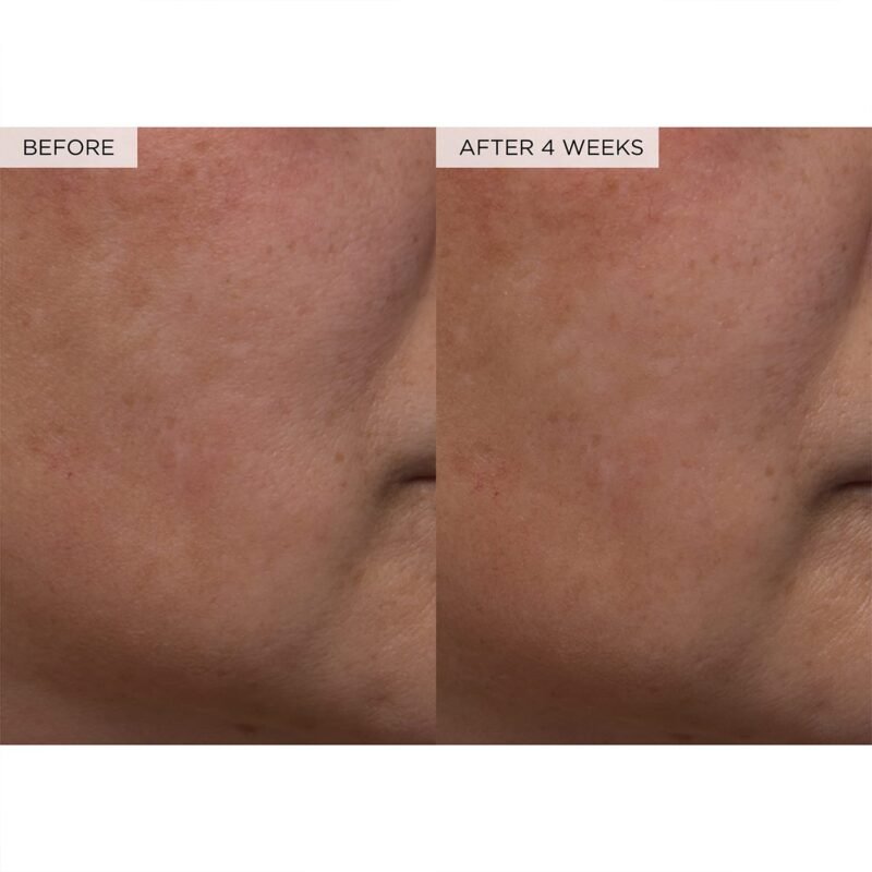 Glow Recipe PHA + BHA Face Toner - Korean Skin Care Pore Minimizer & Gentle Facial Exfoliator for Tightening, Hydrating & Exfoliating - Glycerin, Watermelon & Cactus Water (40ml) - Image 9