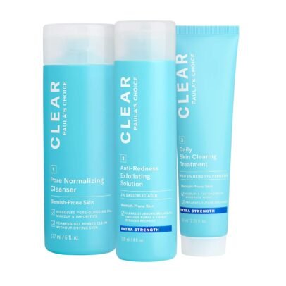 acne treatment