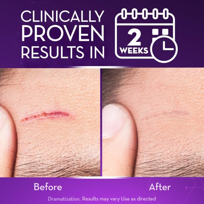 Cicatricure Advanced Scar Gel for Face & Body - Proven Results in 2 Weeks, Scar Treatment for Surgical Scars, Stretch Marks, Scars of Burns and Injuries, Acne Scar Treatment, 1 oz (28 g) - Pack of 3 - Image 3
