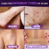 Cicatricure Advanced Scar Gel for Face & Body - Proven Results in 2 Weeks, Scar Treatment for Surgical Scars, Stretch Marks, Scars of Burns and Injuries, Acne Scar Treatment, 1 oz (28 g) - Pack of 3 - Image 4
